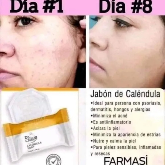 Jabón Caléndula - Picture 4 of 6